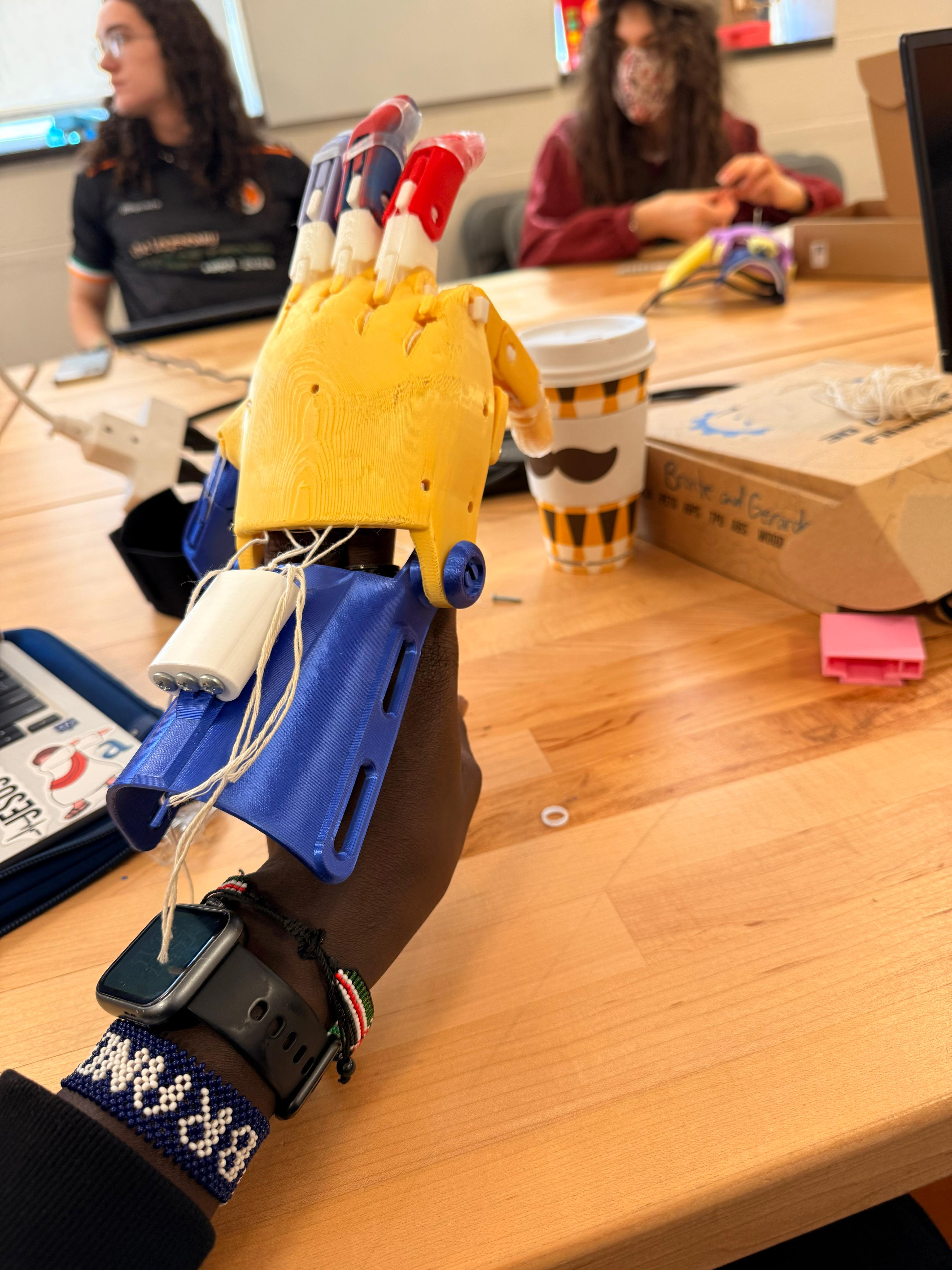 Completed prosthetic hand